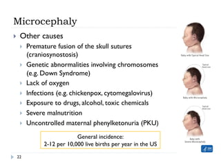 Microcephaly
}  Other causes
}  Premature fusion of the skull sutures
(craniosynostosis)
}  Genetic abnormalities involving chromosomes
(e.g. Down Syndrome)
}  Lack of oxygen
}  Infections (e.g. chickenpox, cytomegalovirus)
}  Exposure to drugs, alcohol, toxic chemicals
}  Severe malnutrition
}  Uncontrolled maternal phenylketonuria (PKU)
22
General incidence:
2-12 per 10,000 live births per year in the US
 