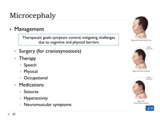 Microcephaly
}  Management
}  Surgery (for craniosynostosis)
}  Therapy
}  Speech
}  Physical
}  Occupational
}  Medications
}  Seizures
}  Hyperactivity
}  Neuromuscular symptoms
Therapeutic goals: symptom control, mitigating challenges
due to cognitive and physical barriers
23
 