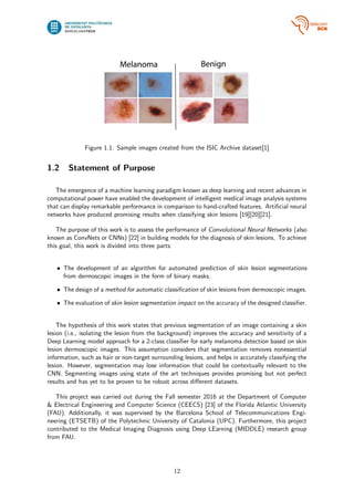 Skin lesion detection from dermoscopic images using Convolutional ...
