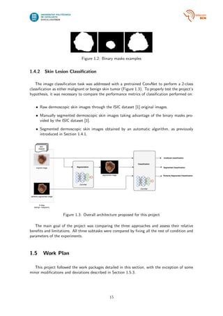 Skin lesion detection from dermoscopic images using Convolutional ...