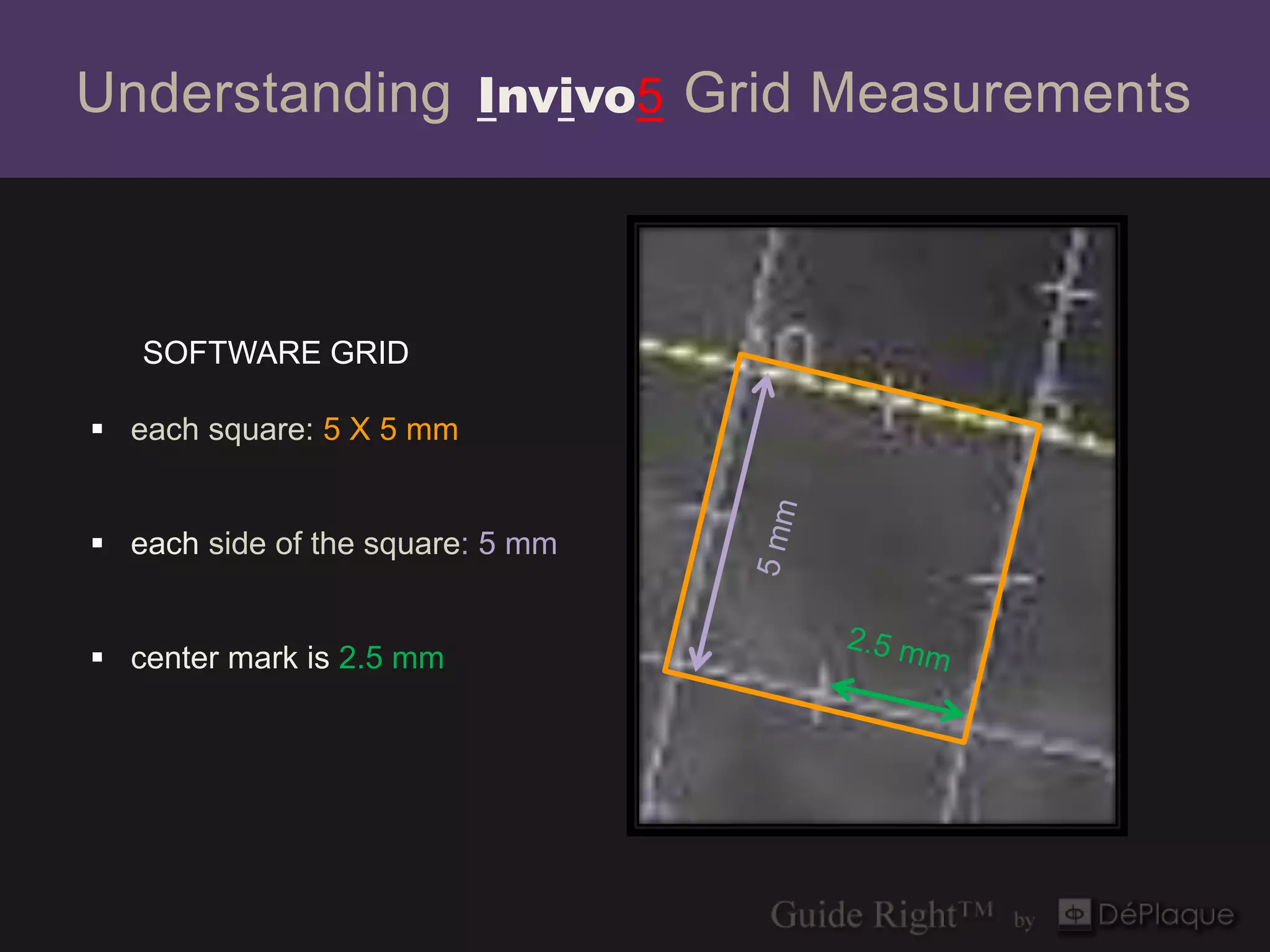 Understanding Invivo5 Grid Measurements



   SOFTWARE GRID

 each square: 5 X 5 mm


 each side of the square: 5 mm


 center mark is 2.5 mm


                                  tangential
 