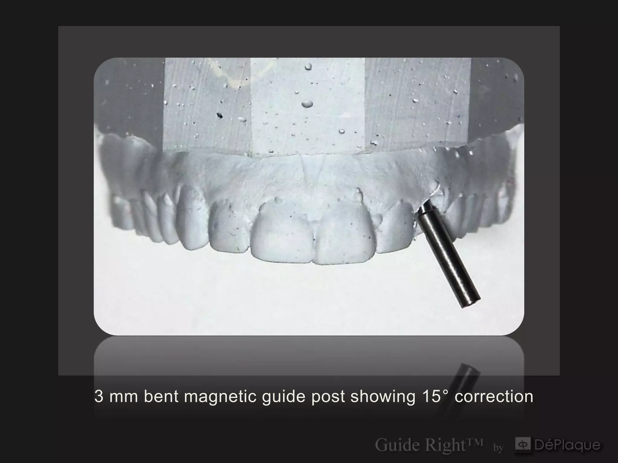 3 mm bent magnetic guide post showing 15° correction
 