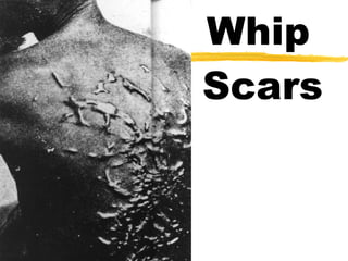 Whip  Scars 