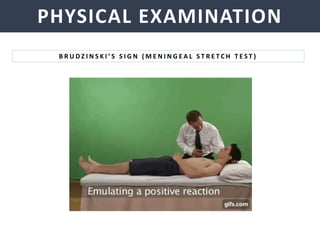 NEISSERIA MENINGITIDIS
PHYSICAL EXAMINATION
B R U D Z I N S K I ’ S S I G N ( M E N I N G E A L S T R E T C H T E S T )
 