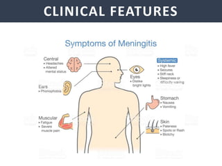 NEISSERIA MENINGITIDIS
CLINICAL FEATURES
 