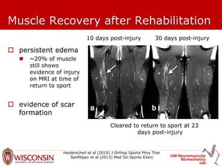 UW Neuromuscular
Biomechanics
Lab
Muscle Recovery after Rehabilitation
10 days post-injury 30 days post-injury
Cleared to return to sport at 23
days post-injury
Heiderscheit et al (2010) J Orthop Sports Phys Ther
Sanfilippo et al (2013) Med Sci Sports Exerc
 persistent edema
 ~20% of muscle
still shows
evidence of injury
on MRI at time of
return to sport
 evidence of scar
formation
 
