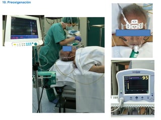 10. Preoxigenación
 