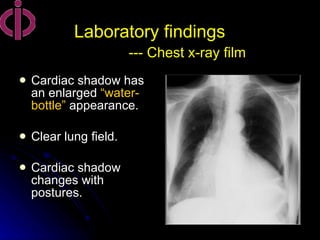 17 pericardial disease | PPT