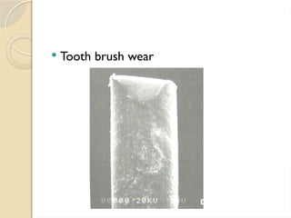  Tooth brush wear
 