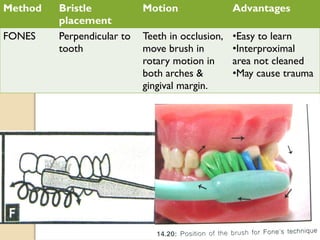 Method Bristle
placement
Motion Advantages
FONES Perpendicular to
tooth
Teeth in occlusion,
move brush in
rotary motion in
both arches &
gingival margin.
•Easy to learn
•Interproximal
area not cleaned
•May cause trauma
 