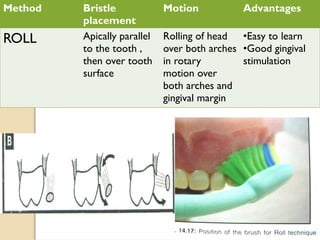 Method Bristle
placement
Motion Advantages
ROLL Apically parallel
to the tooth ,
then over tooth
surface
Rolling of head
over both arches
in rotary
motion over
both arches and
gingival margin
•Easy to learn
•Good gingival
stimulation
 