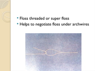  Floss threaded or super floss
 Helps to negotiate floss under archwires
 