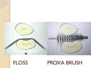 FLOSS PROXA BRUSH
 