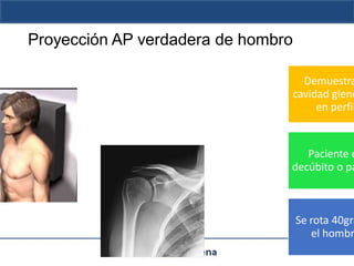 1proyecciones radiologicas basicastrm.pdf