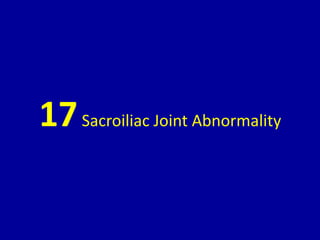 17Sacroiliac Joint Abnormality
 