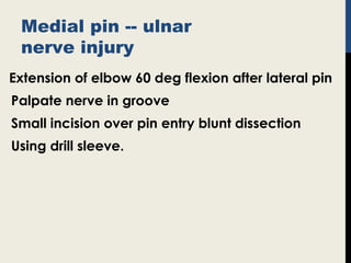 Medial pin -- ulnar
nerve injury
Extension of elbow 60 deg flexion after lateral pin
Palpate nerve in groove
Small incision over pin entry blunt dissection
Using drill sleeve.
 