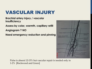VASCULAR INJURY
Brachial artery injury / vascular
insufficiency
Assess by color, warmth, capillary refill
Angiogram ? NO
Need emergency reduction and pinning
Pulse is absent 12-15% but vascular repair is needed only in
1-2% [Rockwood and Green]
 