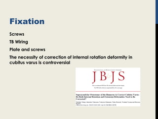 Fixation
Screws
TB Wiring
Plate and screws
The necessity of correction of internal rotation deformity in
cubitus varus is controversial
 
