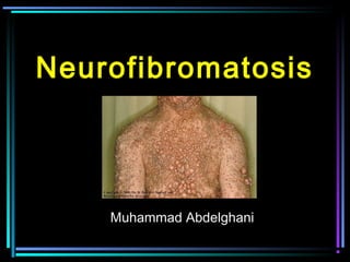 Neurofibromatosis
Muhammad Abdelghani
 
