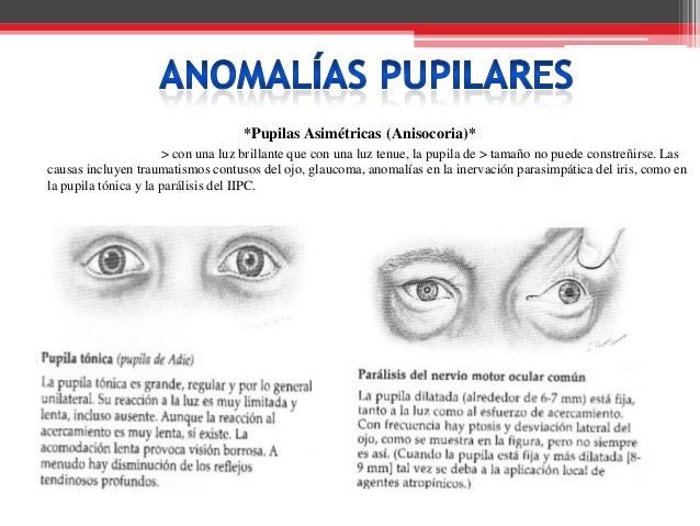 El emplasto de los círculos oscuros y las bolsas en los ojos
