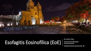 Esofagitis Eosinofílica (EoE)
Dr. Juan D. Díaz
Servicio de Endoscopia
Gastrointestinal
Hospital General de Zona No. 35
 
