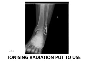 18.1 Ionising radiation put to use 