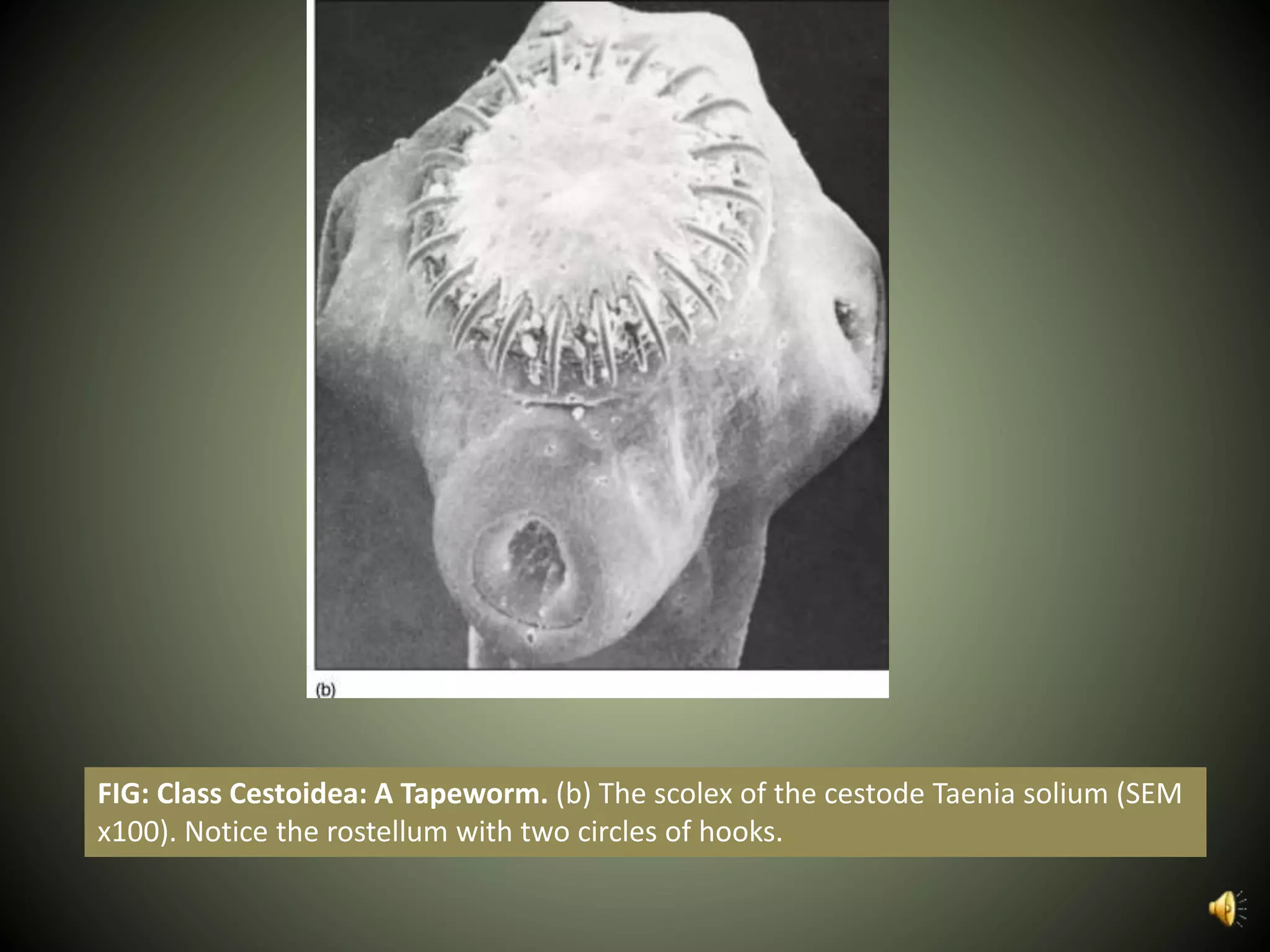 FIG: Class Cestoidea: A Tapeworm. (b) The scolex of the cestode Taenia solium (SEM
x100). Notice the rostellum with two circles of hooks.
 