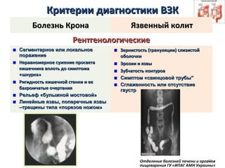 20
Критерии диагностики ВЗККритерии диагностики ВЗК
Болезнь КронаБолезнь Крона Язвенный колитЯзвенный колит
РентгенологическиеРентгенологические
Сегментарное или локальноеСегментарное или локальное
поражениепоражение
Неравномерное сужение просветаНеравномерное сужение просвета
кишечника вплоть до симптомакишечника вплоть до симптома
«шнурка»«шнурка»
Ригидность кишечной стенки и ееРигидность кишечной стенки и ее
бахромчатые очертаниябахромчатые очертания
Рельеф «булыжной мостовой»Рельеф «булыжной мостовой»
Линейные язвы, поперечные язвыЛинейные язвы, поперечные язвы
–трещины типа «порезов ножом»–трещины типа «порезов ножом»
Зернистость (грануляции) слизистойЗернистость (грануляции) слизистой
оболочкиоболочки
Эрозии и язвыЭрозии и язвы
Зубчатость контуровЗубчатость контуров
Симптом «Симптом «свинцовой трубысвинцовой трубы””
Сглаженность или отсутствиеСглаженность или отсутствие
гаустргаустр
Отделение болезней печени и органов
пищеварения ГУ «ИПАГ АМН Украины»
 