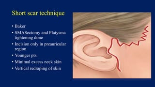 Preauricular Incision Steps Face lift - Rhytidectomy | PPTX