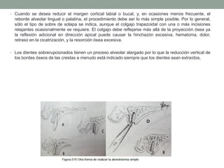 • Cuando se desea reducir el margen cortical labial o bucal, y, en ocasiones menos frecuente, el
reborde alveolar lingual o palatina, el procedimiento debe ser lo más simple posible. Por lo general,
sólo el tipo de sobre de solapa se indica, aunque el colgajo trapezoidal con una o más incisiones
relajantes ocasionalmente se requiere. El colgajo debe reflejarse más allá de la proyección ósea ya
la reflexión adicional en dirección apical puede causar la hinchazón excesiva, hematoma, dolor,
retraso en la cicatrización, y la resorción ósea excesiva.
• Los dientes sobrerupcionados tienen un proceso alveolar alargado por lo que la reducción vertical de
los bordes óseos de las crestas a menudo está indicado siempre que los dientes sean extraídos.
 
