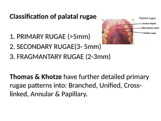Classification of palatal rugae
1. PRIMARY RUGAE (>5mm)
2. SECONDARY RUGAE(3- 5mm)
3. FRAGMANTARY RUGAE (2-3mm)
Thomas & Khotze have further detailed primary
rugae patterns into: Branched, Unified, Cross-
linked, Annular & Papillary.
Palatal rugae
 