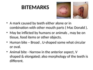 BITEMARKS
• A mark caused by teeth either alone or in
combination with other mouth parts ( Mac Donald ).
• May be inflicted by humans or animals , may be on
tissue, food items or other objects.
• Human bite – Broad , U-shaped some what circular
or oval.
• Animal bite - Narrow in the anterior aspect, V
shaped & elongated; also morphology of the teeth is
different.
 