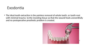 Prosthesis Extraction Drive 18. Exodontia and it’s Principle.pptx oral and facial | PPTX