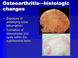 Comprehensive Overview of Bone and Joint Anatomy, Growth, Disorders ...
