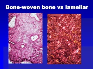 Comprehensive Overview of Bone and Joint Anatomy, Growth, Disorders ...