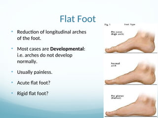 18-Common foot and ankle disorders orthopaedics.ppt