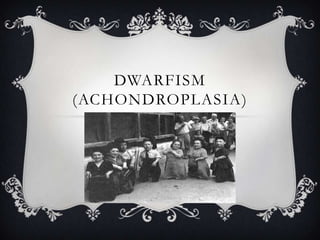 DWARFISM
(ACHONDROPLASIA)
 