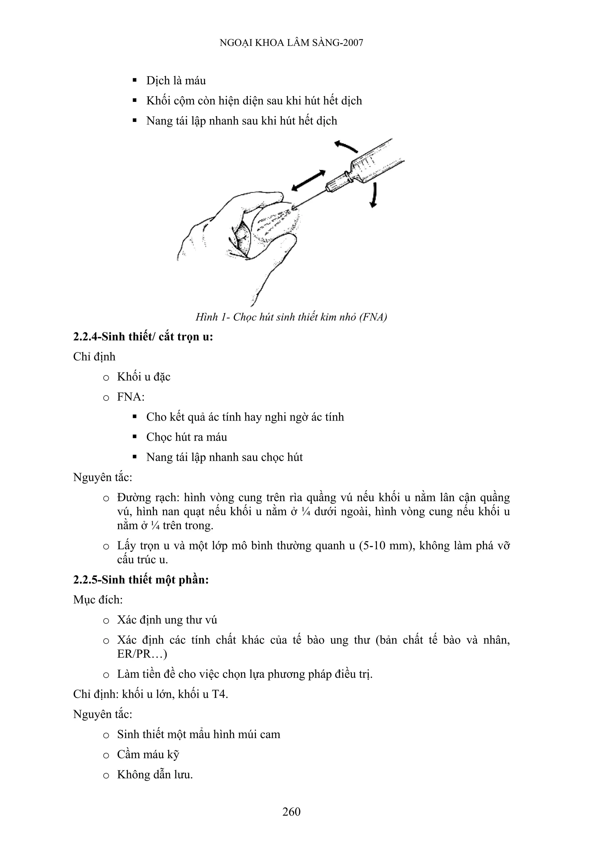 NGOẠI KHOA LÂM SÀNG-2007


               Dịch là máu
               Khối cộm còn hiện diện sau khi hút hết dịch
               Nang tái lập nhanh sau khi hút hết dịch




                         Hình 1- Chọc hút sinh thiết kim nhỏ (FNA)
2.2.4-Sinh thiết/ cắt trọn u:
Chỉ định
      o Khối u đặc
      o FNA:
               Cho kết quả ác tính hay nghi ngờ ác tính
               Chọc hút ra máu
               Nang tái lập nhanh sau chọc hút
Nguyên tắc:
      o Đường rạch: hình vòng cung trên rìa quầng vú nếu khối u nằm lân cận quầng
        vú, hình nan quạt nếu khối u nằm ở ¼ dưới ngoài, hình vòng cung nếu khối u
        nằm ở ¼ trên trong.
      o Lấy trọn u và một lớp mô bình thường quanh u (5-10 mm), không làm phá vỡ
        cấu trúc u.
2.2.5-Sinh thiết một phần:
Mục đích:
      o Xác định ung thư vú
      o Xác định các tính chất khác của tế bào ung thư (bản chất tế bào và nhân,
        ER/PR…)
      o Làm tiền đề cho việc chọn lựa phương pháp điều trị.
Chỉ định: khối u lớn, khối u T4.
Nguyên tắc:
      o Sinh thiết một mẩu hình múi cam
      o Cầm máu kỹ
      o Không dẫn lưu.


                                           260
 