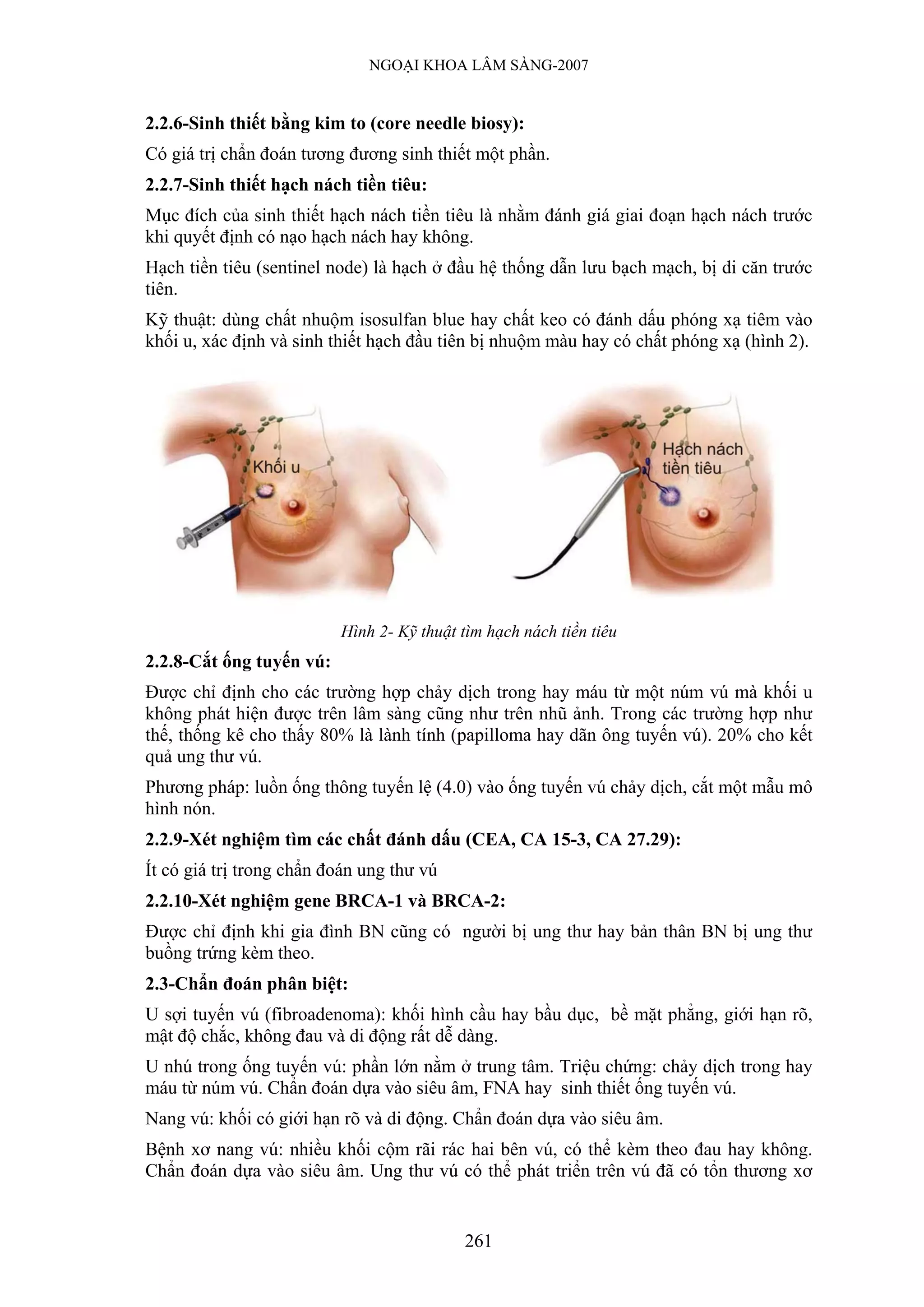 NGOẠI KHOA LÂM SÀNG-2007


2.2.6-Sinh thiết bằng kim to (core needle biosy):
Có giá trị chẩn đoán tương đương sinh thiết một phần.
2.2.7-Sinh thiết hạch nách tiền tiêu:
Mục đích của sinh thiết hạch nách tiền tiêu là nhằm đánh giá giai đoạn hạch nách trước
khi quyết định có nạo hạch nách hay không.
Hạch tiền tiêu (sentinel node) là hạch ở đầu hệ thống dẫn lưu bạch mạch, bị di căn trước
tiên.
Kỹ thuật: dùng chất nhuộm isosulfan blue hay chất keo có đánh dấu phóng xạ tiêm vào
khối u, xác định và sinh thiết hạch đầu tiên bị nhuộm màu hay có chất phóng xạ (hình 2).




                          Hình 2- Kỹ thuật tìm hạch nách tiền tiêu
2.2.8-Cắt ống tuyến vú:
Được chỉ định cho các trường hợp chảy dịch trong hay máu từ một núm vú mà khối u
không phát hiện được trên lâm sàng cũng như trên nhũ ảnh. Trong các trường hợp như
thế, thống kê cho thấy 80% là lành tính (papilloma hay dãn ông tuyến vú). 20% cho kết
quả ung thư vú.
Phương pháp: luồn ống thông tuyến lệ (4.0) vào ống tuyến vú chảy dịch, cắt một mẫu mô
hình nón.
2.2.9-Xét nghiệm tìm các chất đánh dấu (CEA, CA 15-3, CA 27.29):
Ít có giá trị trong chẩn đoán ung thư vú
2.2.10-Xét nghiệm gene BRCA-1 và BRCA-2:
Được chỉ định khi gia đình BN cũng có người bị ung thư hay bản thân BN bị ung thư
buồng trứng kèm theo.
2.3-Chẩn đoán phân biệt:
U sợi tuyến vú (fibroadenoma): khối hình cầu hay bầu dục, bề mặt phẳng, giới hạn rõ,
mật độ chắc, không đau và di động rất dễ dàng.
U nhú trong ống tuyến vú: phần lớn nằm ở trung tâm. Triệu chứng: chảy dịch trong hay
máu từ núm vú. Chẩn đoán dựa vào siêu âm, FNA hay sinh thiết ống tuyến vú.
Nang vú: khối có giới hạn rõ và di động. Chẩn đoán dựa vào siêu âm.
Bệnh xơ nang vú: nhiều khối cộm rãi rác hai bên vú, có thể kèm theo đau hay không.
Chẩn đoán dựa vào siêu âm. Ung thư vú có thể phát triển trên vú đã có tổn thương xơ


                                           261
 