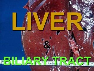 Chapter 18 LIVER 
& 
BILIARY TRACT 
 