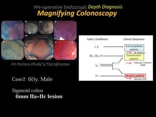 Endoscopy in Gastrointestinal Oncology - Slide 18 - T. Matsuda ...