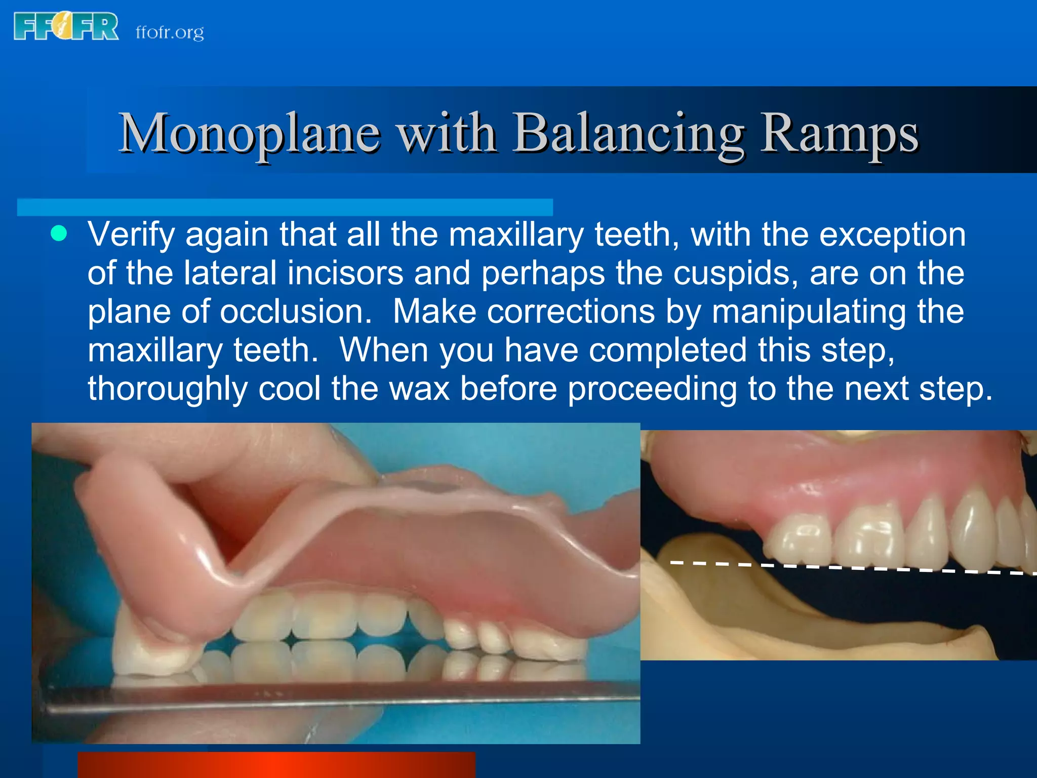 Maxillary Ramps 18.occlusal schemes monoplane with balancing ramps | PPT