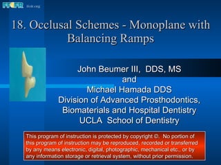 18. Occlusal Schemes - Monoplane with Balancing Ramps John Beumer III,  DDS, MS and Michael Hamada DDS Division of Advanced Prosthodontics, Biomaterials and Hospital Dentistry UCLA  School of Dentistry This program of instruction is protected by copyright ©.  No portion of this program of instruction may be reproduced, recorded or transferred by any means electronic, digital, photographic, mechanical etc., or by any information storage or retrieval system, without prior permission. 