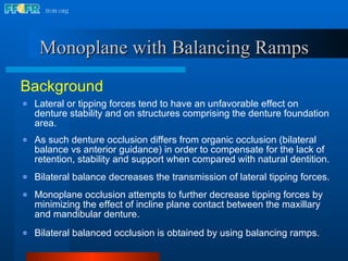 18.occlusal schemes monoplane with balancing ramps | PPT