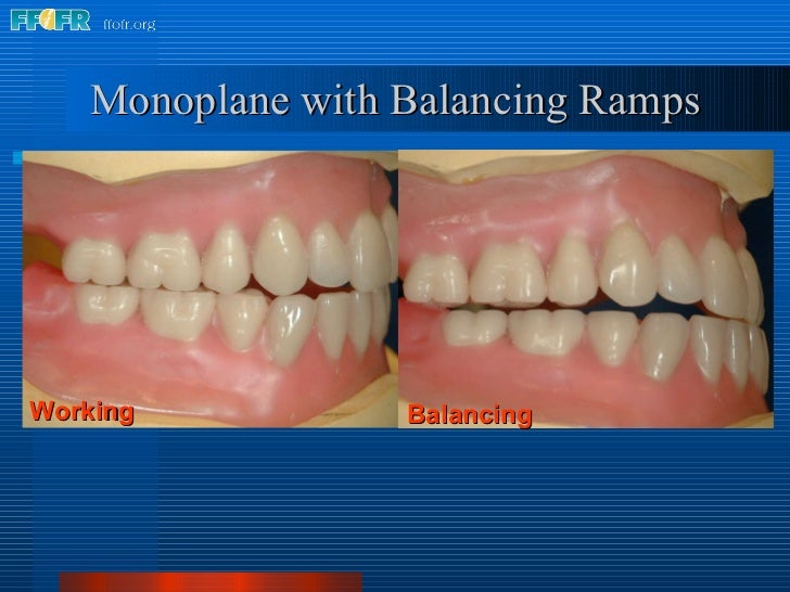 18.occlusal schemes monoplane with balancing ramps