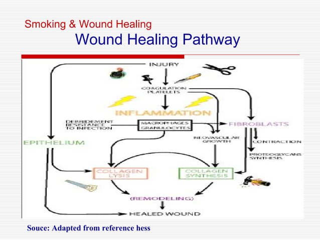 18. Smoking And Wound Healing | PPT