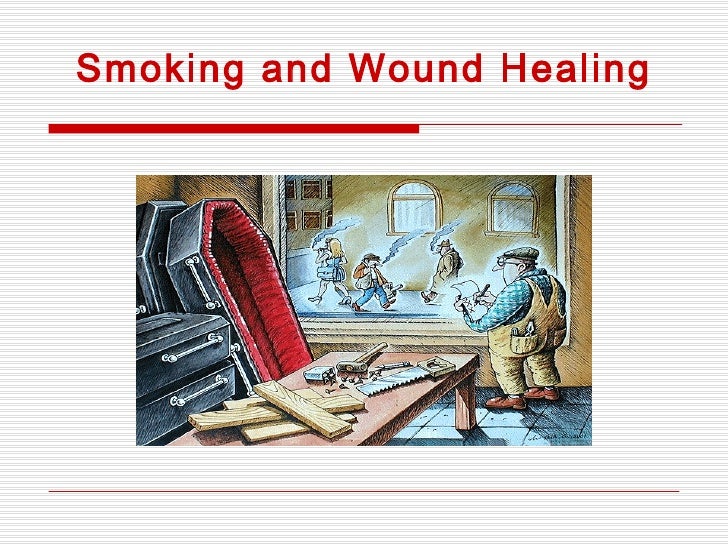 18. Smoking And Wound Healing