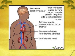 18 Sobrepeso y Obesidad