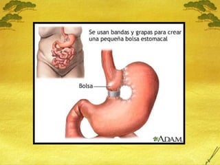 18 Sobrepeso y Obesidad