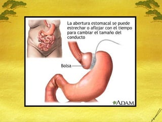 18 Sobrepeso y Obesidad